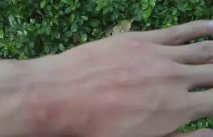 夏季宝宝驱蚊手环产品推荐,品牌驱蚊手环婴儿专用