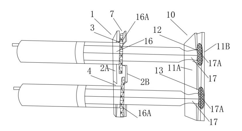 单手双腔封管,单手双管冲管法