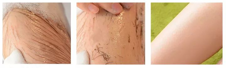 有什么办法脱毛之后不再长,怎样脱毛不再长最有效方法