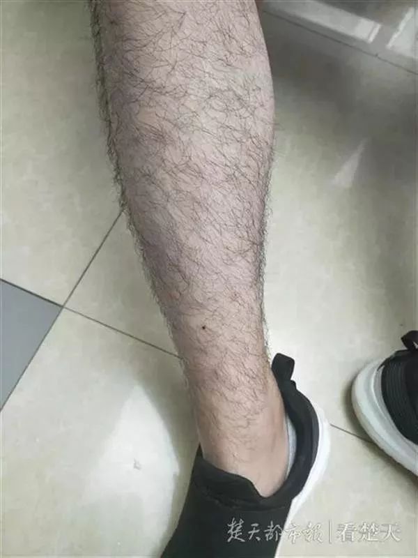 女孩随手拍了一只虫子,不能随便用手拍死的虫子有哪些