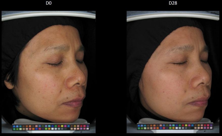 疯狂美白,这四种美白方法千万别乱试