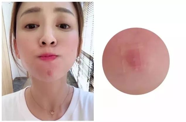 灰头土脸怎么改善,灰头土脸怎么预防