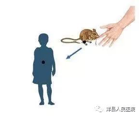 健康科普肾综合征出血热知多少,健康知识科普肾衰竭的症状表现