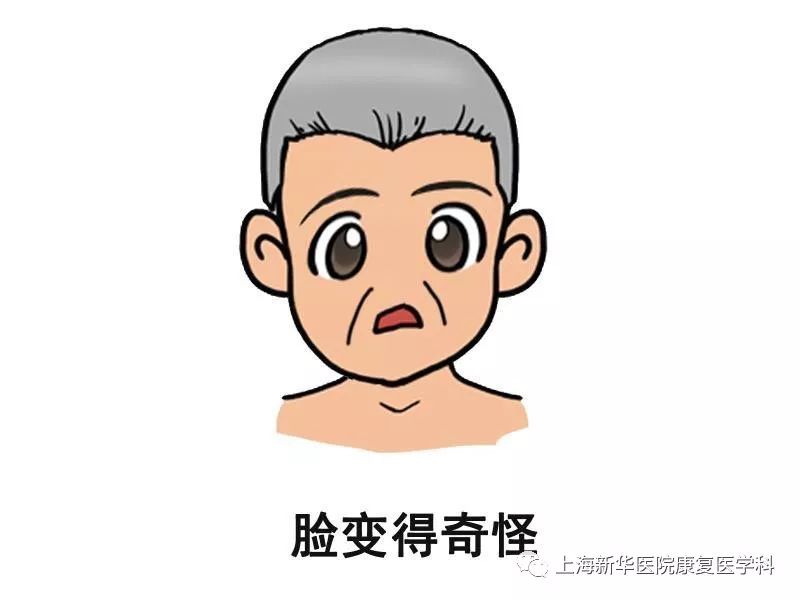 脑卒中恢复期作业疗法训练方法,脑卒中恢复期保持什么卧位