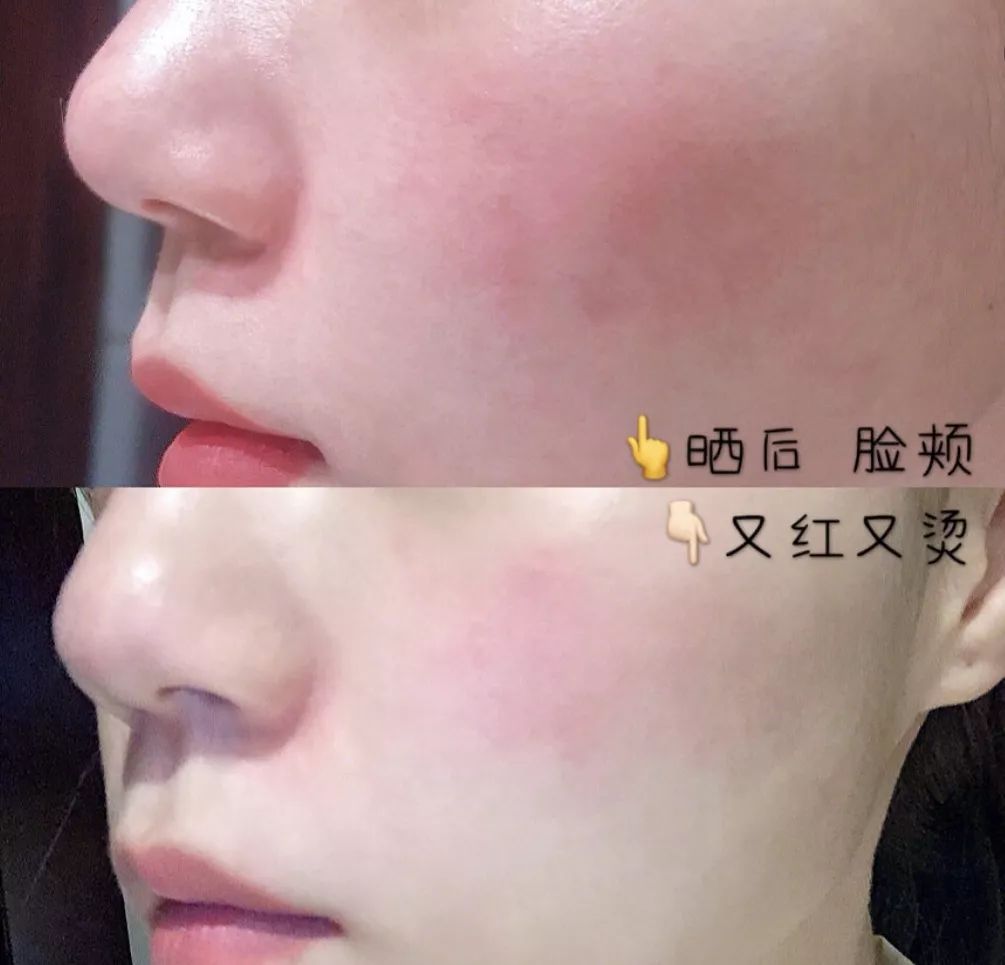 有必要用哪一款水乳,一辈子就能用一套水乳