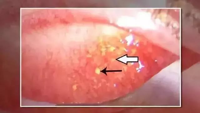 “日本制造”又曝丑闻!违禁成分泛滥,却还有1亿中国人疯抢