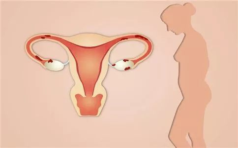 70%患者初诊竟已是晚期！成都专家疾呼：这样做尽量远离“女性杀手”！