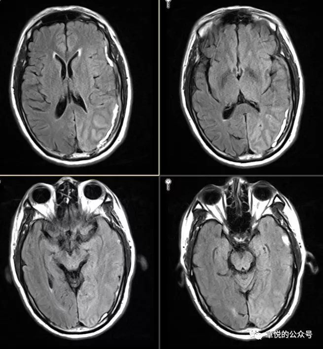 「章悦故事汇」华山“一针灵”