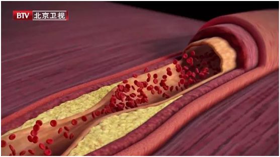 脑供血不足能彻底治好吗,脑供血不足很难治吗