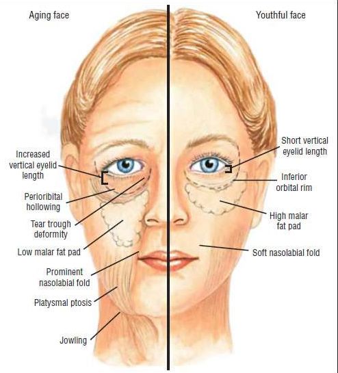 不削骨改变脸型,不削骨变脸型