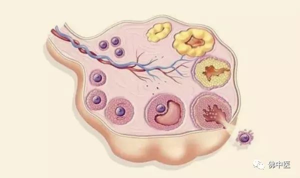 绝经八年多了查出卵巢囊肿严重吗,警惕卵巢囊肿恶变