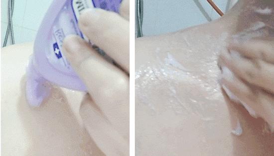 鸡皮肤永久消除,37天快速祛鸡皮肤