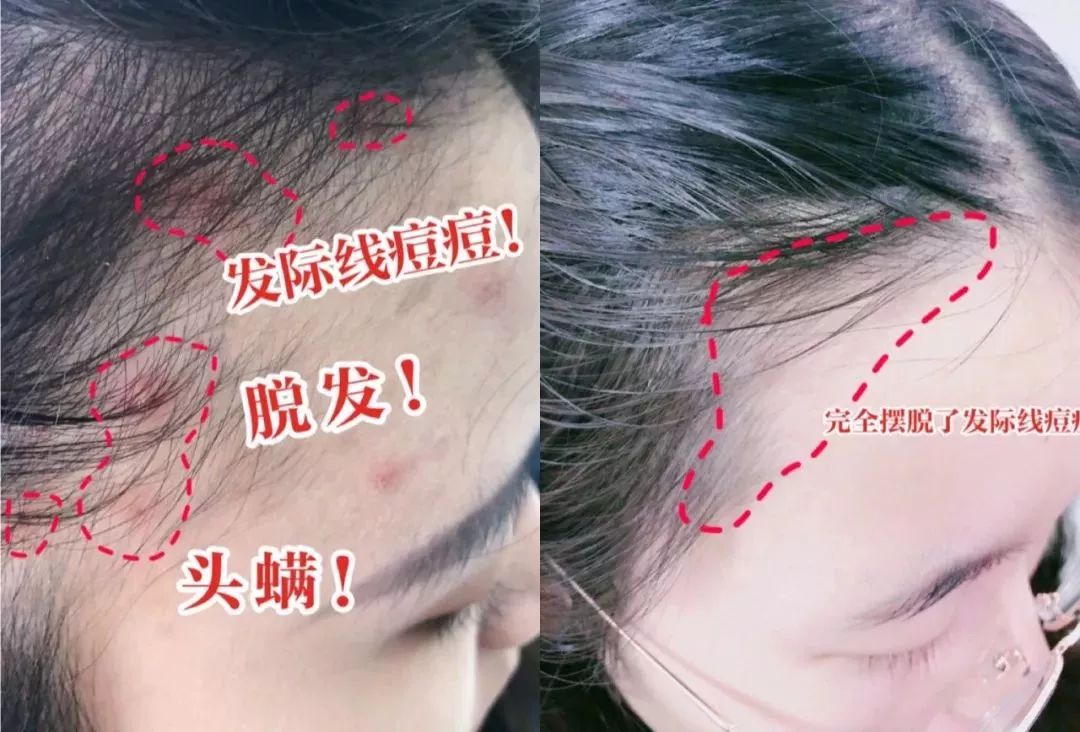 团|你的头发一根都不许掉！用它，还能3天不洗头依然干爽不油腻