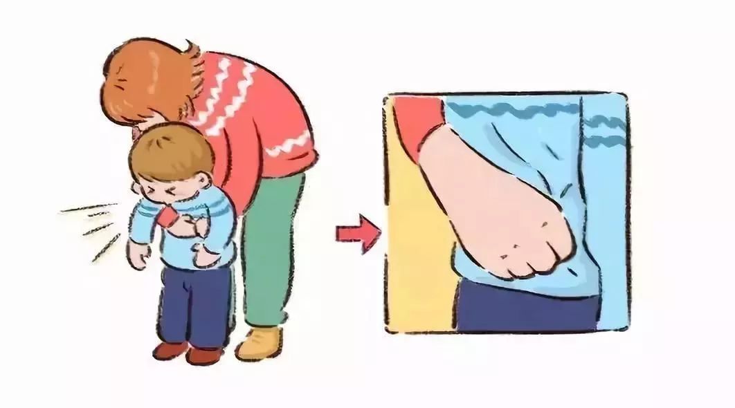 小儿气管异物急救方法视频,小儿气管异物排出三种方法