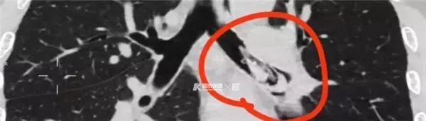 造成虾生病的原因,为什么虾会突然发病