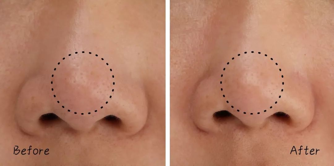 不做清洁面膜护肤品能吸收吗,不做清洁补水有效果吗