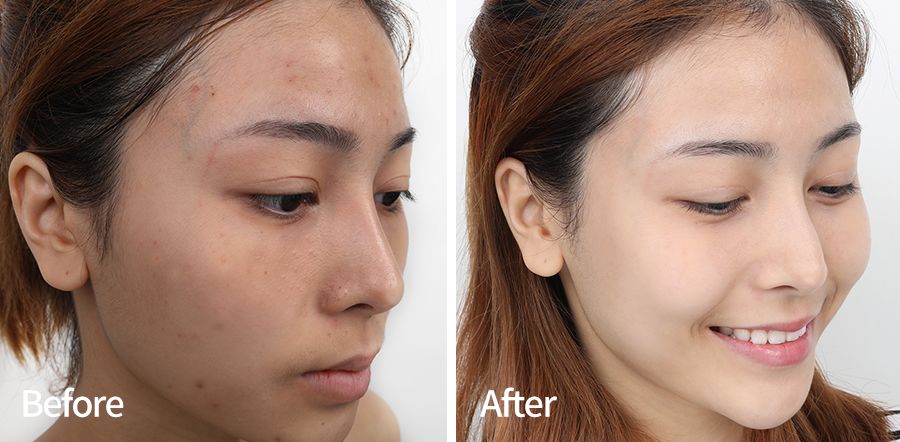 很丑但好用的国货面膜,这款国货面膜如此平价却堪称万能