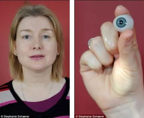 戴隐形眼镜有多可怕,戴隐形眼镜眼睛里长虫子