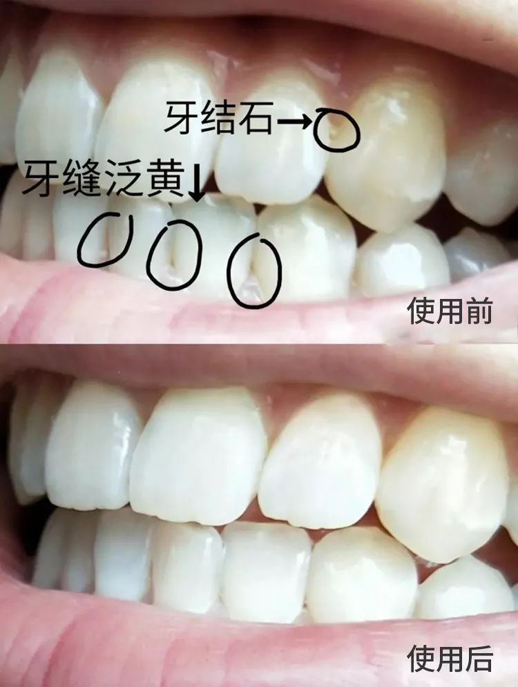 好物丨用它30秒吐掉嘴里所有脏东西,连呼吸都是水果味