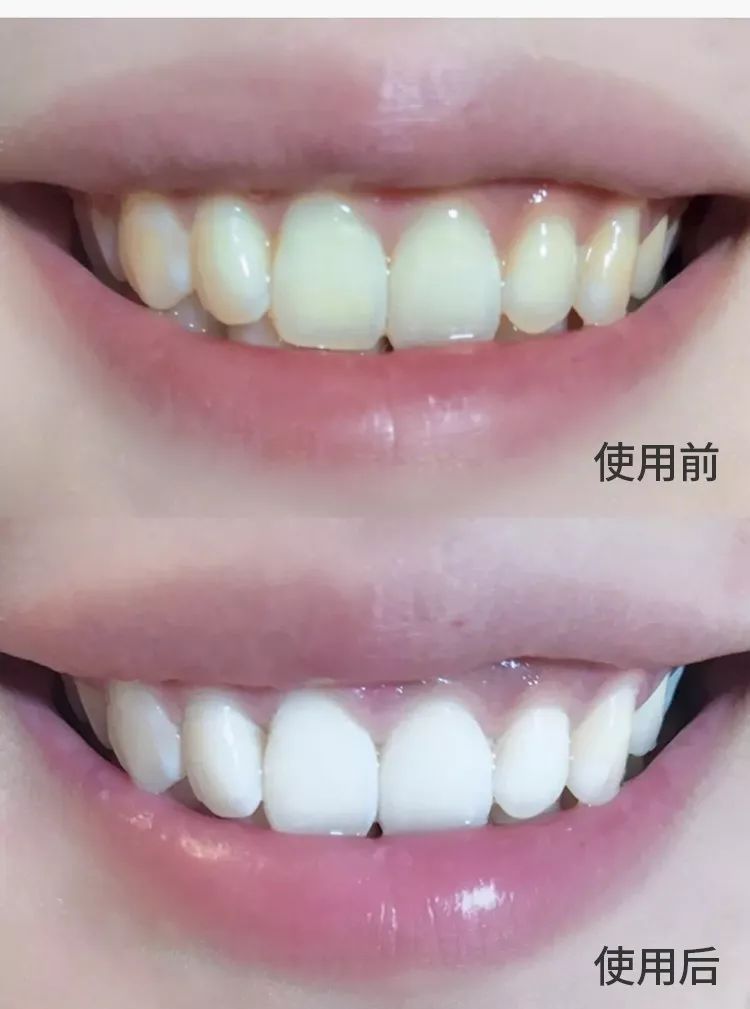 好物丨用它30秒吐掉嘴里所有脏东西,连呼吸都是水果味