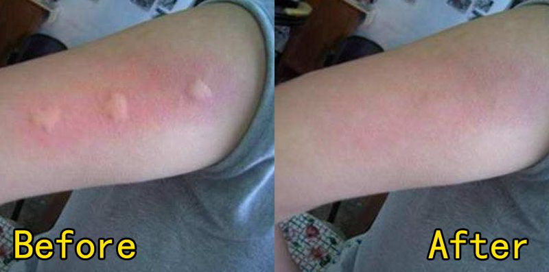 植物妈妈驱蚊喷雾,植物萃取喷雾防蚊驱蚊