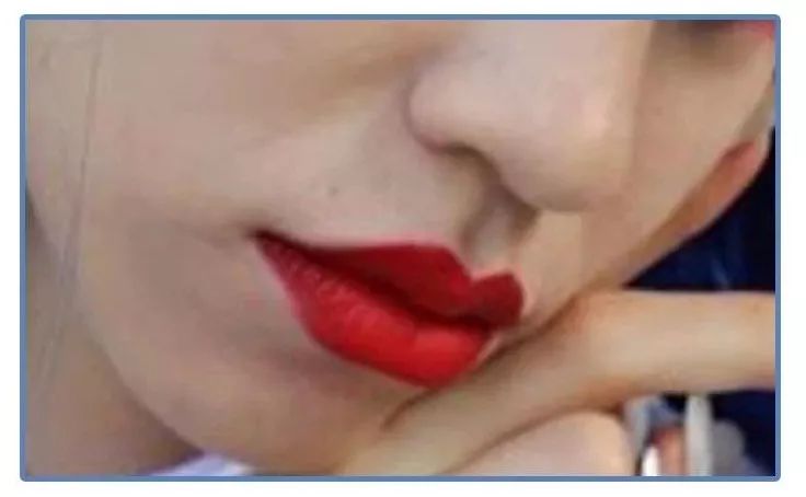 泫雅丰唇后颜值下跌?!但大家都爱这样的“香肠嘴”啊