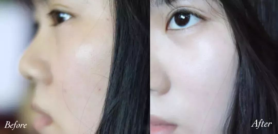 黑科技一秒祛斑,黑科技美白真的有效吗