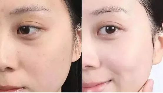 脸上搓下来很多泥,脸上搓出黑头