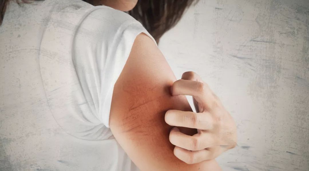 冬天皮肤起皮干燥有碎屑怎么保湿,下巴周围干燥起皮有小疙瘩