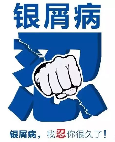 银屑病公益治疗,银屑病哪个专家好治愈率高