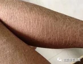 皮肤出现瘙痒是身体有问题吗,皮肤瘙痒可能会预示哪种疾病