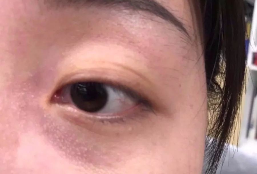 解决皱纹色斑粗糙干燥就用这一套,淡化各种皱纹特别快的好方法