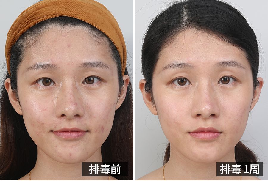 虐哭！50岁“大长今”竟长这样？卸妆后全网男生轰动：糟糕，心动了...