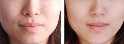 断货半年，抢都抢不到！荣登Cosme榜首，用完肌肤嫩到爆