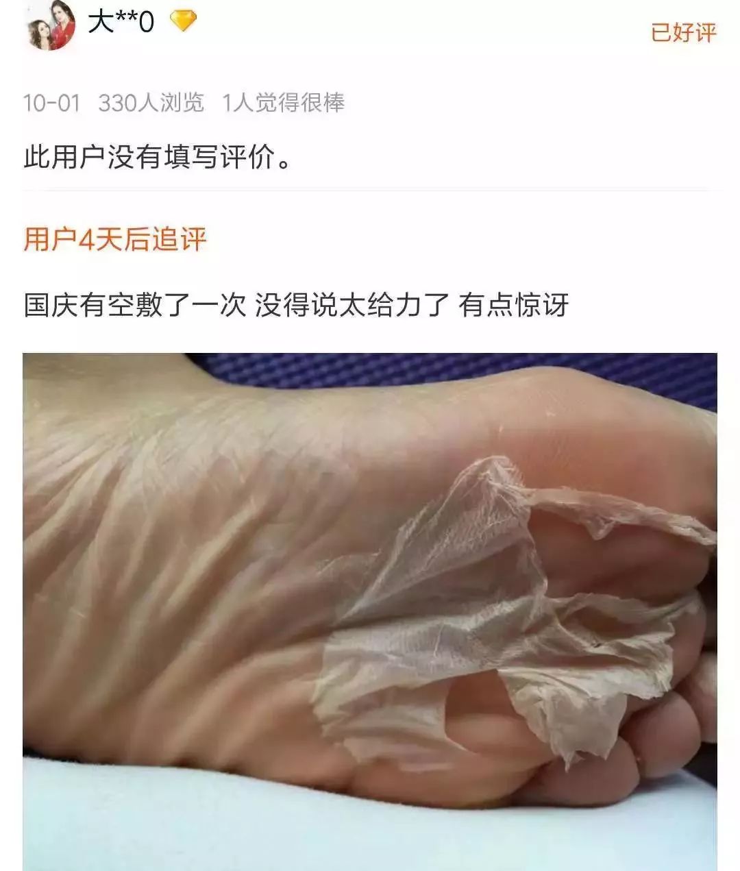 娇嫩双足|堪比“换皮术”的逆天足膜！让双脚像剥鸡蛋壳一样轻松换新皮！60分钟还你柔嫩美足