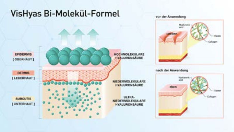 正品抗皱纹玻尿酸原液,vishya和赫梦娜玻尿酸哪个好