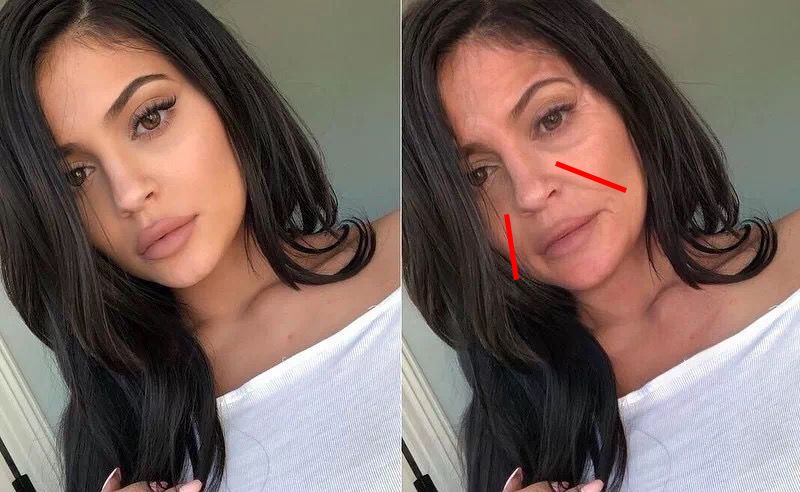 法令纹又黑又长,法令纹又深又长好吗