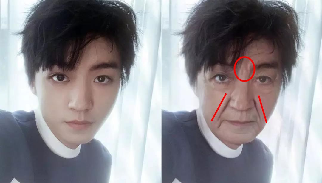 眉间纹和法令纹除皱针能去掉吗,嘴角纹法令纹抬头纹国货推荐