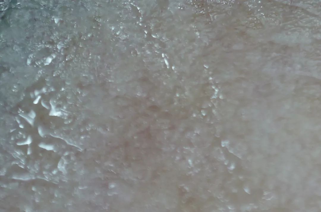 三十岁就有眉间纹法令纹怎么办,30岁法令纹眉心纹深