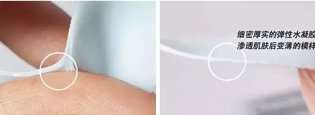 眉间纹和法令纹除皱针能去掉吗,嘴角纹法令纹抬头纹国货推荐