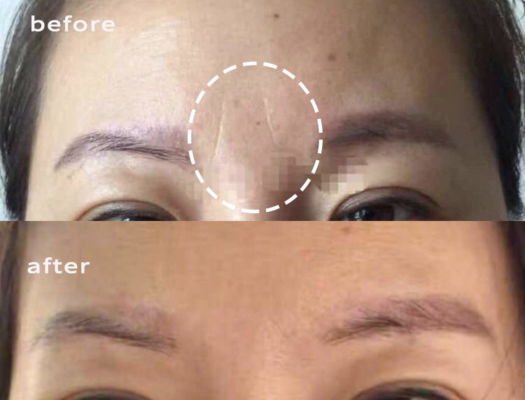 法令纹又黑又长,法令纹又深又长好吗