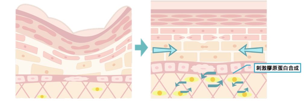 4成抗衰老眼霜抗衰老功效并不显著，同样功效的眼霜价格竟相差7倍？小鱼抗衰老眼霜绿鱼榜单为你揭晓