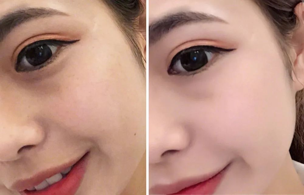 用它洗脸，脏东西自己浮出来，比做10次面膜还管用！丨开团