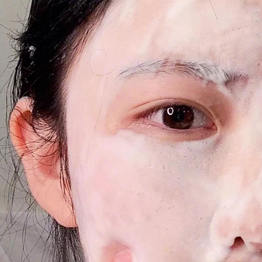 用它洗脸，脏东西自己浮出来，比做10次面膜还管用！丨开团