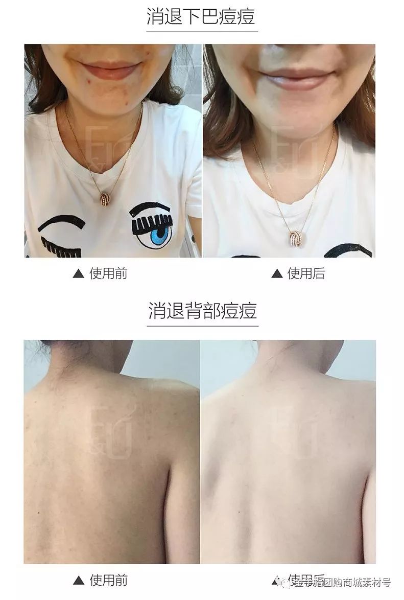 金手指线上团购,金手指团购套装