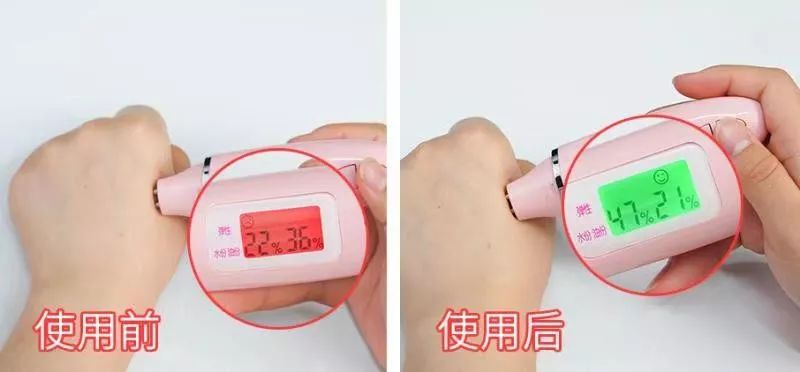 眼袋松弛下垂最快解决方法,严重眼袋下垂松弛怎么恢复