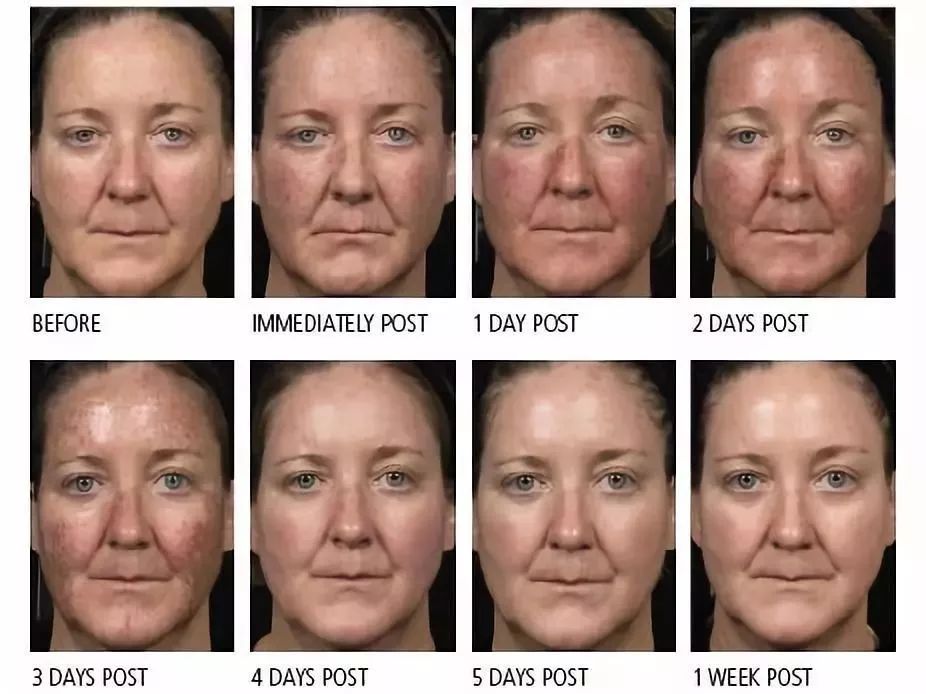 关于医美的真相大全,两年医美的真实感受