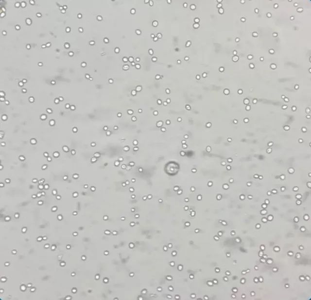 儿童大便里有霉菌的治疗,小孩粪便检查出霉菌