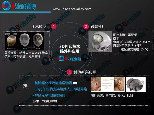 神经修复技术3d打印,神经外科3d打印技术定位更精确
