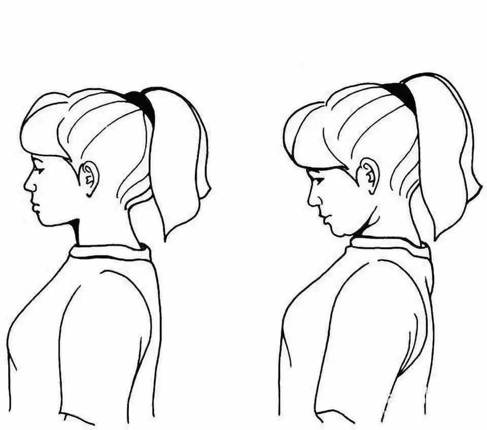 脖子睡觉落枕了怎么最快恢复视频,落枕要怎样的睡觉姿势有助于恢复